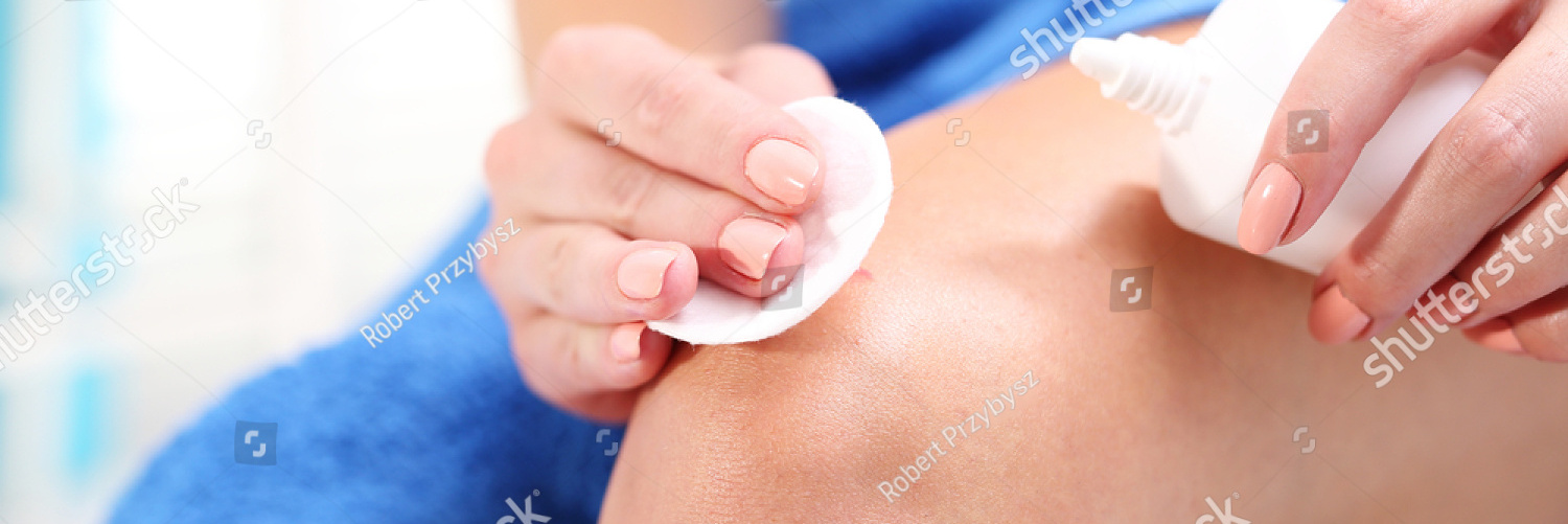 stock photo disinfection of wounds with hydrogen peroxide female disinfects the wound on his knee pouring with 457868704
